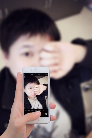 各种毁容，不能见人了！遮遮掩掩来一张！希望快点好起来！