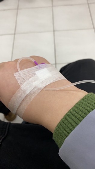 吊水，两个小时。